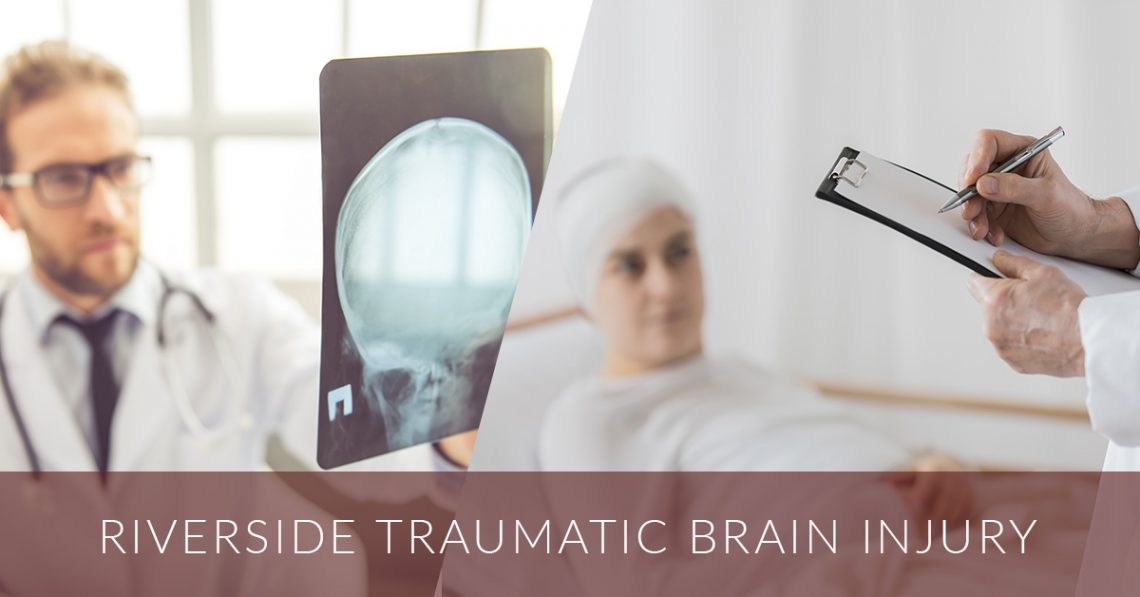 Riverside Traumatic Brain Injury Lawyer